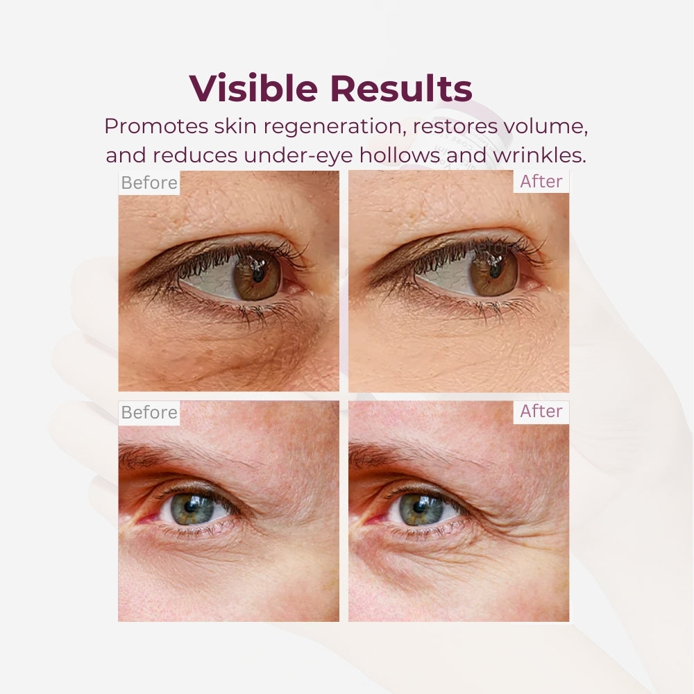 Orvian Calcium Wrinkle Repair Balm