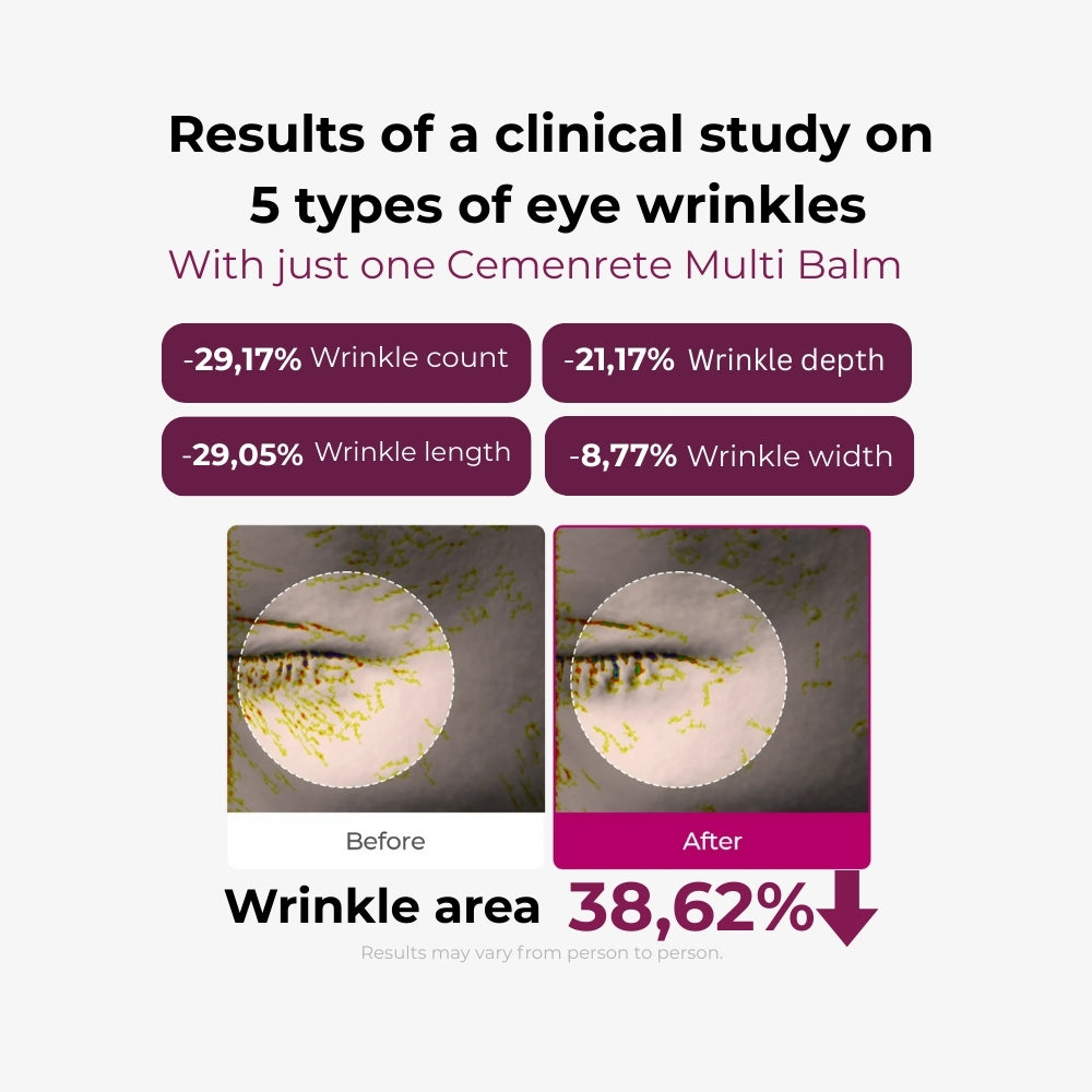 Orvian Calcium Wrinkle Repair Balm