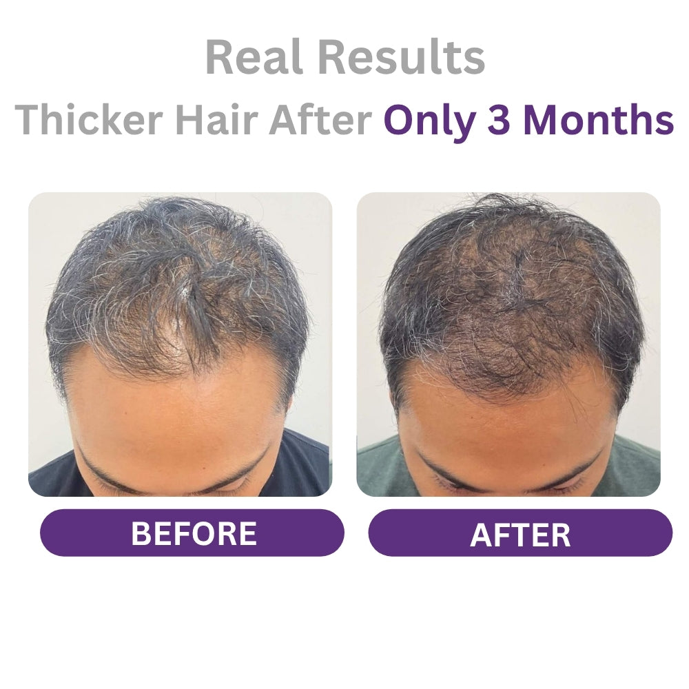Orvian Hair Serum